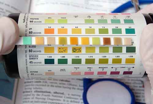 Understanding Urine Test Results