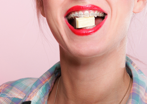 Foods You Can't Eat With Braces