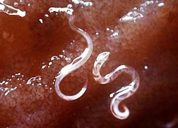 How To Prevent Getting Infected With Intestinal Parasites