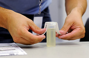 What Is Urine Drug Screen?