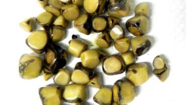 What Are Gallstones And How Do These Stones Form Inside Our Gut?