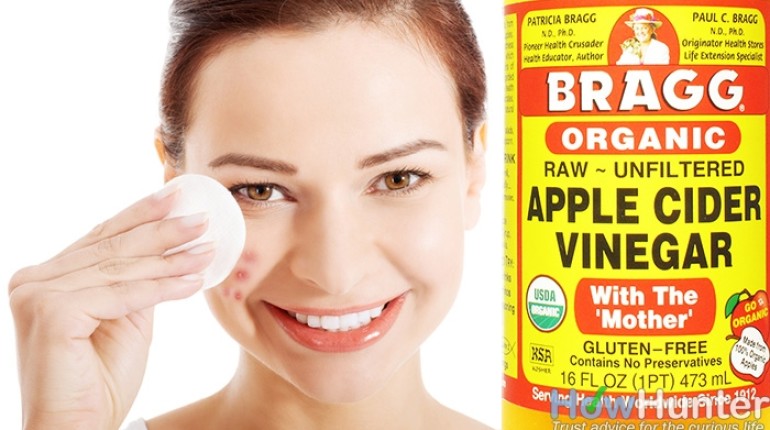 Apple Cider Vinegar For Acne: The Best Way To Achieve That Clearer, Glowing Skin