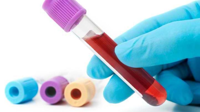 Understanding Herpes Blood Test