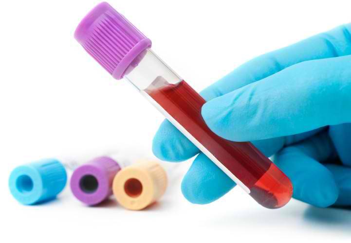 western blot test for herpes
