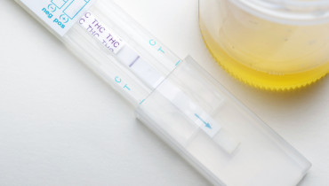 What You Must Know About Urine Test For Alcohol