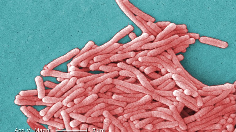 Is Legionnaires' Disease Contagious?