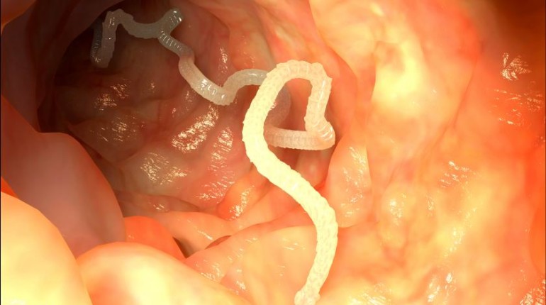 How To Prevent Getting Infected With Intestinal Parasites