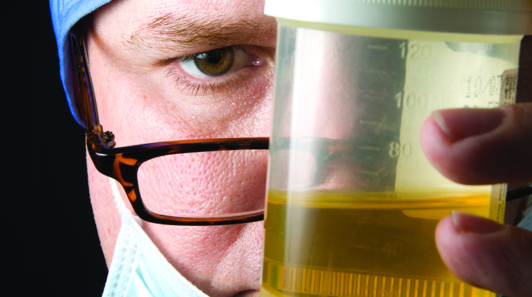 What Is Urine Drug Screen?